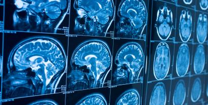 Images of brain scans