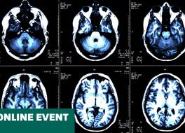Six brain scan images from an MRI scan