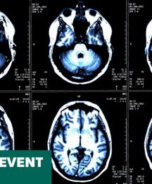Six brain scan images from an MRI scan