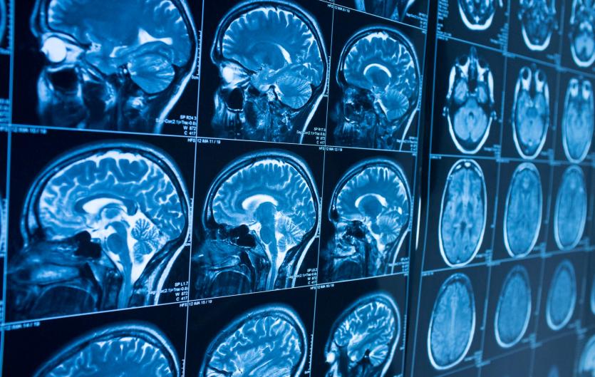 Research Images of brain scans