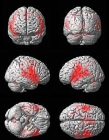 Six brain scans, each one highlighting different areas of the brain